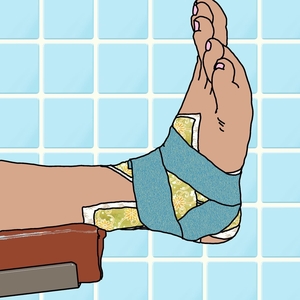 「足関節捻挫テーピングのあれこれ。」の画像